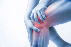 artrosis, también llamada osteoartritis